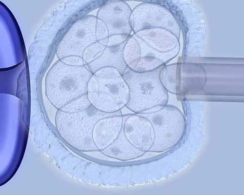 做试管一共要花多少钱.西府辅孕什么活动