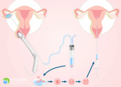 海外代孕的花费,代孕靠谱中心哪里有,2026年东营做试管第三代花费多少钱？