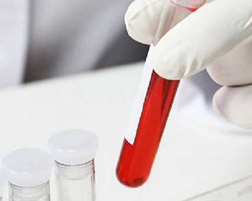 试管移植之后的人可以吃生蚝吗孕妇吃多少