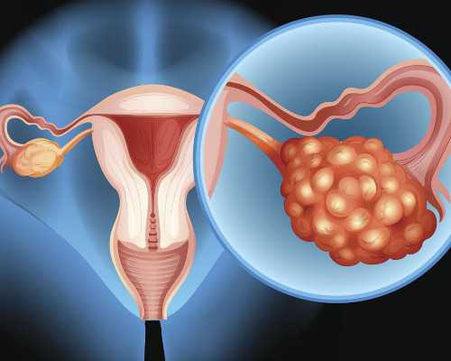 试管移植14天后还会生化吗孕妇会流产吗
