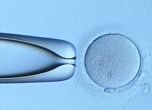 试管婴儿的产检能报生育险吗多少钱一个月