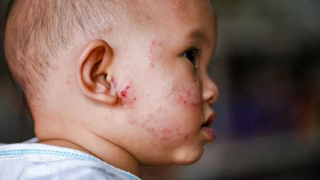 移植鲜胚第十一天没有出血正常吗会着床吗