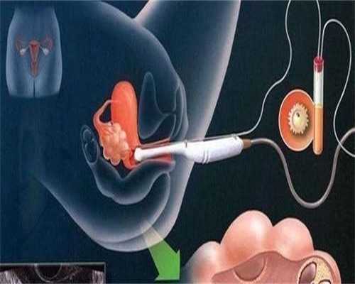 试管促排第八天雌二醇1万多正常吗为什么